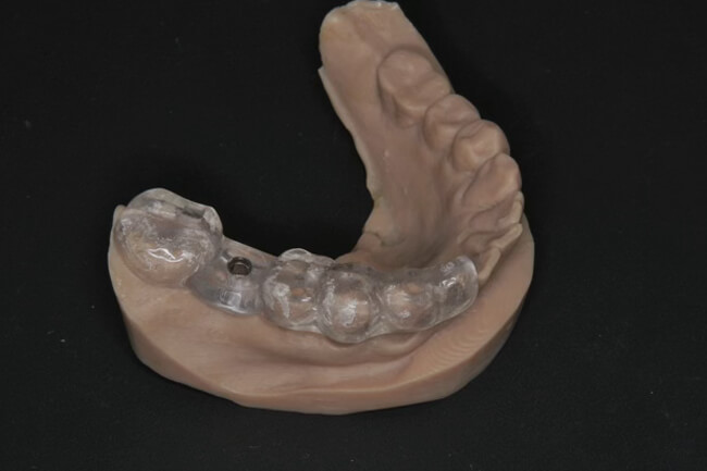 全症例でサージカルガイドを使用した安全な手術01