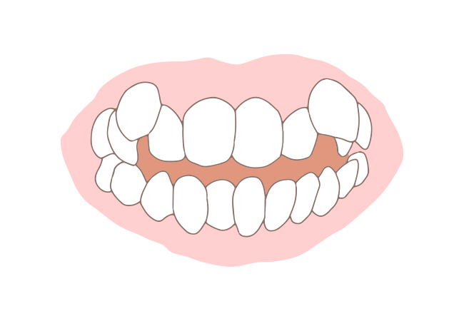 叢生(そうせい)